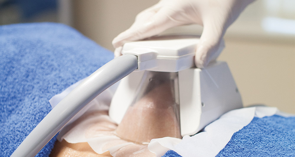 How Fat Freezing and HIFU Work Together? 2 Multiple Areas in One Session HIFU and Fat Freezing Weybridge