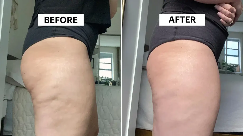 Do Toning Exercise Weybridge Really Tackle Cellulite?